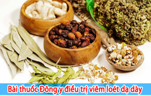 bai-thuoc-dong-y-dieu-tri-viem-loet-da-day